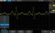 Siglent SDS2000XP-FG Built-in 50MHz Waveform Generator Software Option/1CH, SDS2000X+ Series