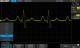 Siglent SDS2000XP-FG Eingebauter 50MHz Wellenformgenerator Software Option/1CH, SDS2000X+ Serie